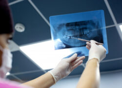 dentist-checks-x-ray-photo-mouth_140725-7691